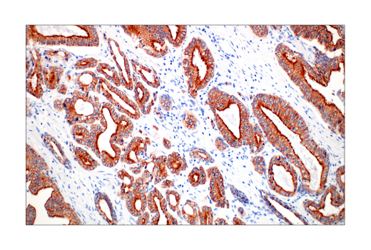  Image 47: Pancreatic Marker IHC Antibody Sampler Kit