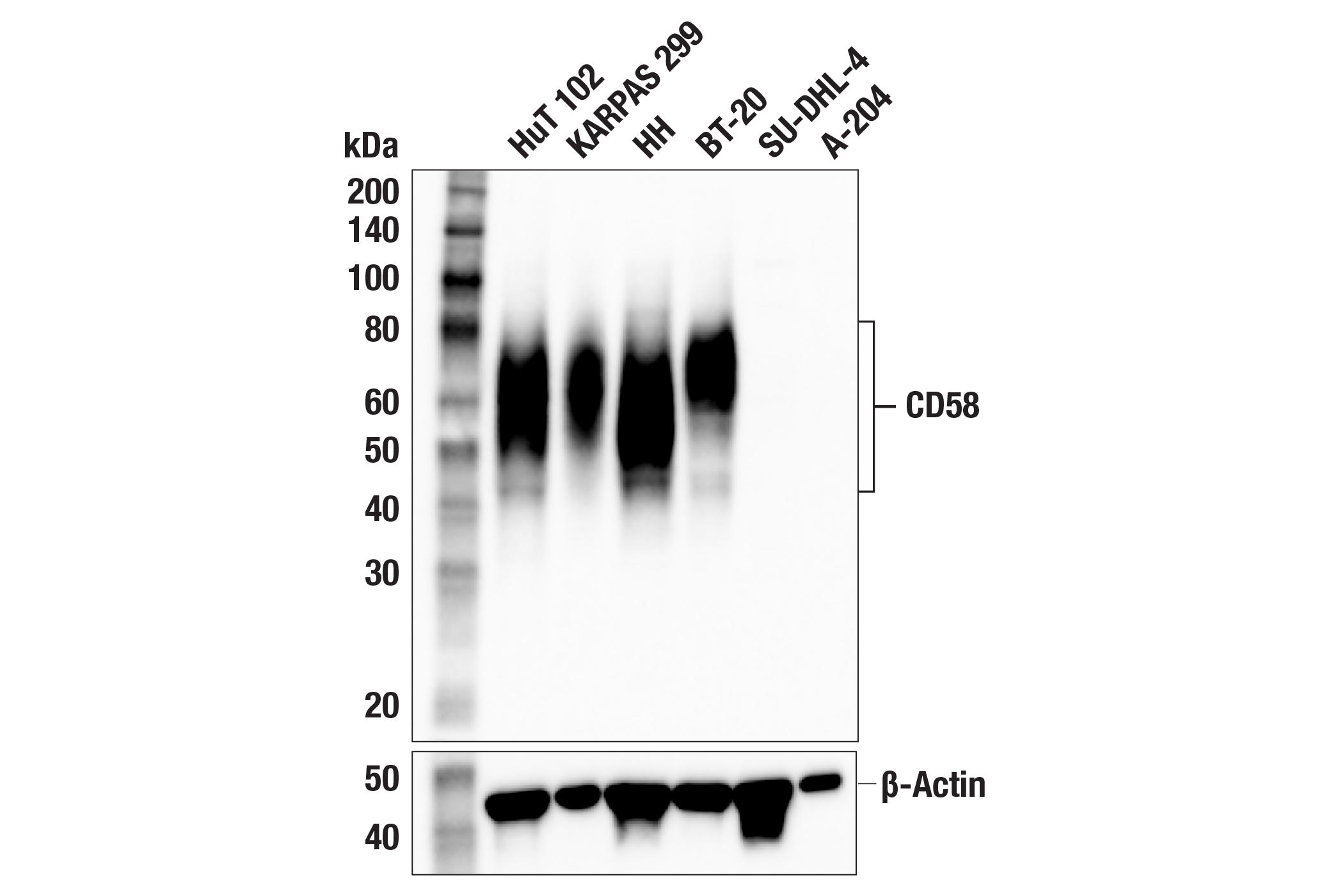 CD58 (F1C9B) Rabbit mAb | Cell Signaling Technology