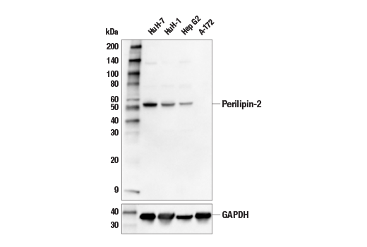 Western Blotting Image 1: Perilipin-2 Antibody