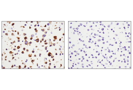  Image 17: Human Reactive M1 vs M2 Macrophage IHC Antibody Sampler Kit