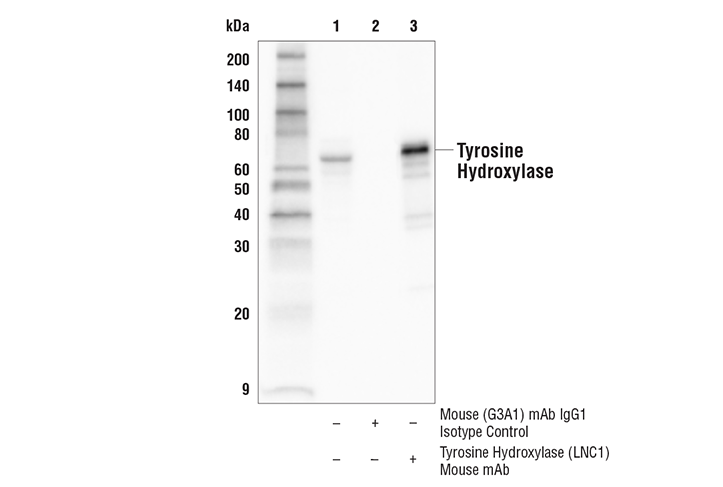 Immunoprecipitation Image 1: Tyrosine Hydroxylase (LNC1) Mouse mAb
