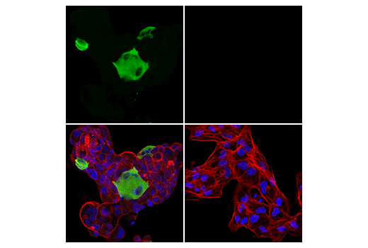 Immunofluorescence Image 2: Tyrosine Hydroxylase (LNC1) Mouse mAb