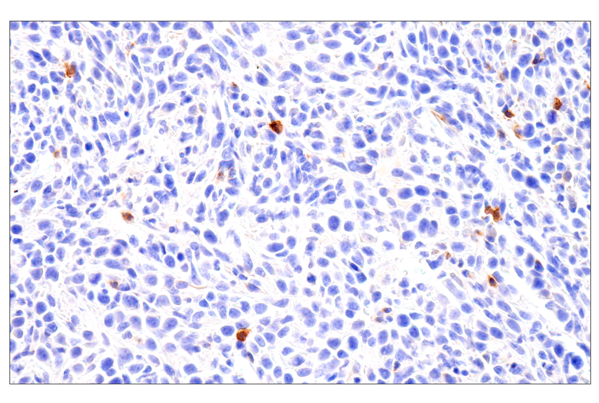 Immunohistochemistry Image 4: CD62L/L-Selectin (E7L2M) Rabbit mAb