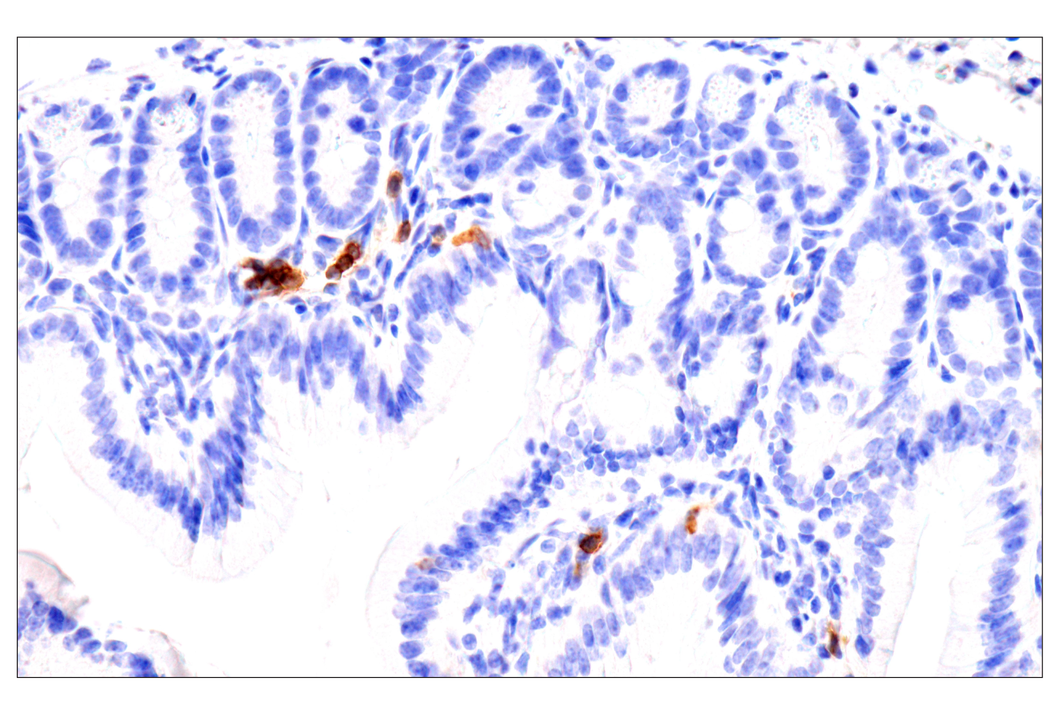 Immunohistochemistry Image 6: CD62L/L-Selectin (E7L2M) Rabbit mAb