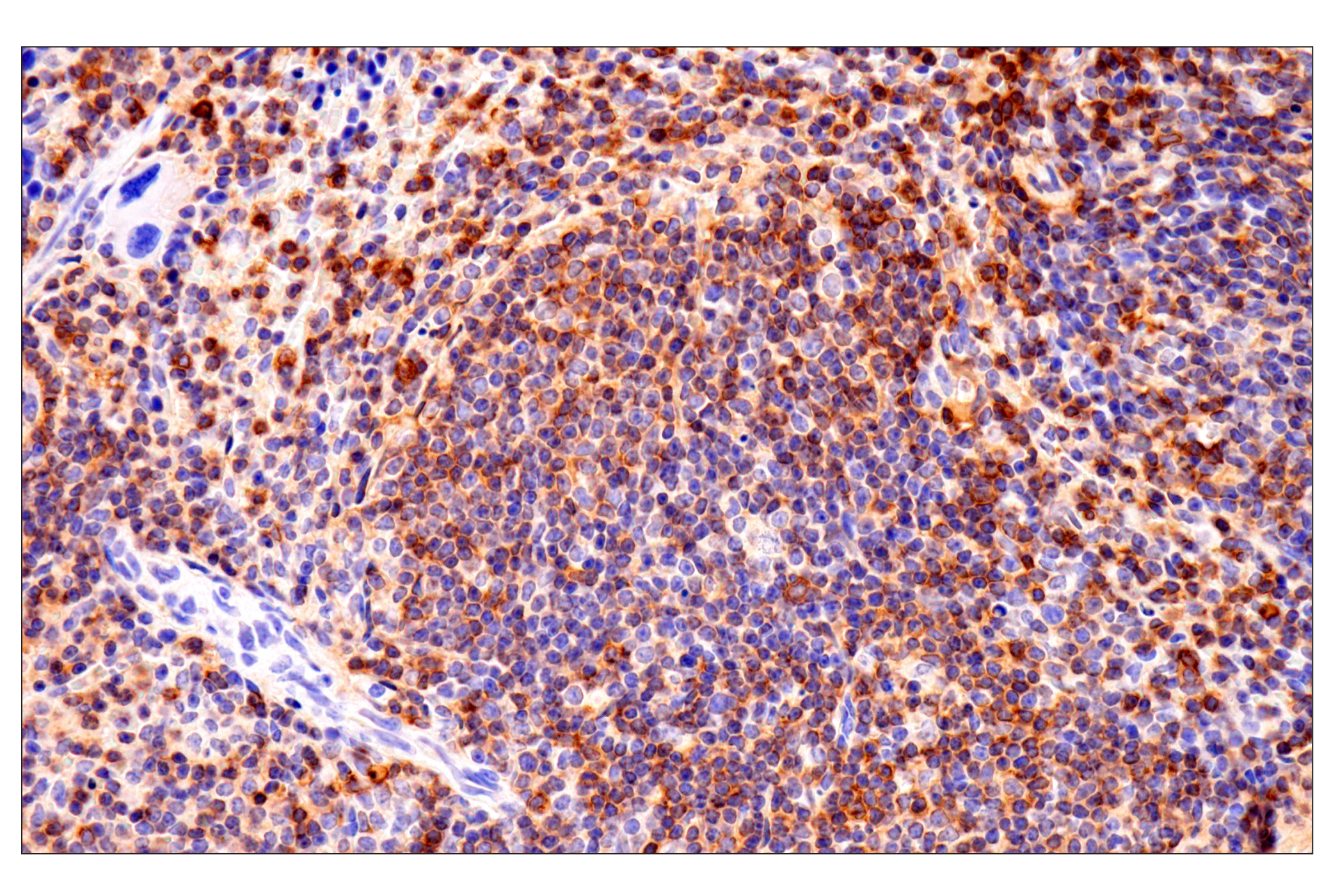 Immunohistochemistry Image 5: CD62L/L-Selectin (E7L2M) Rabbit mAb