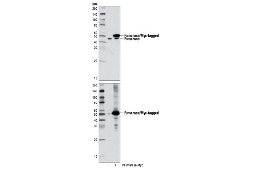 Image 6: Tricarboxylic Acid Cycle Antibody Sampler Kit