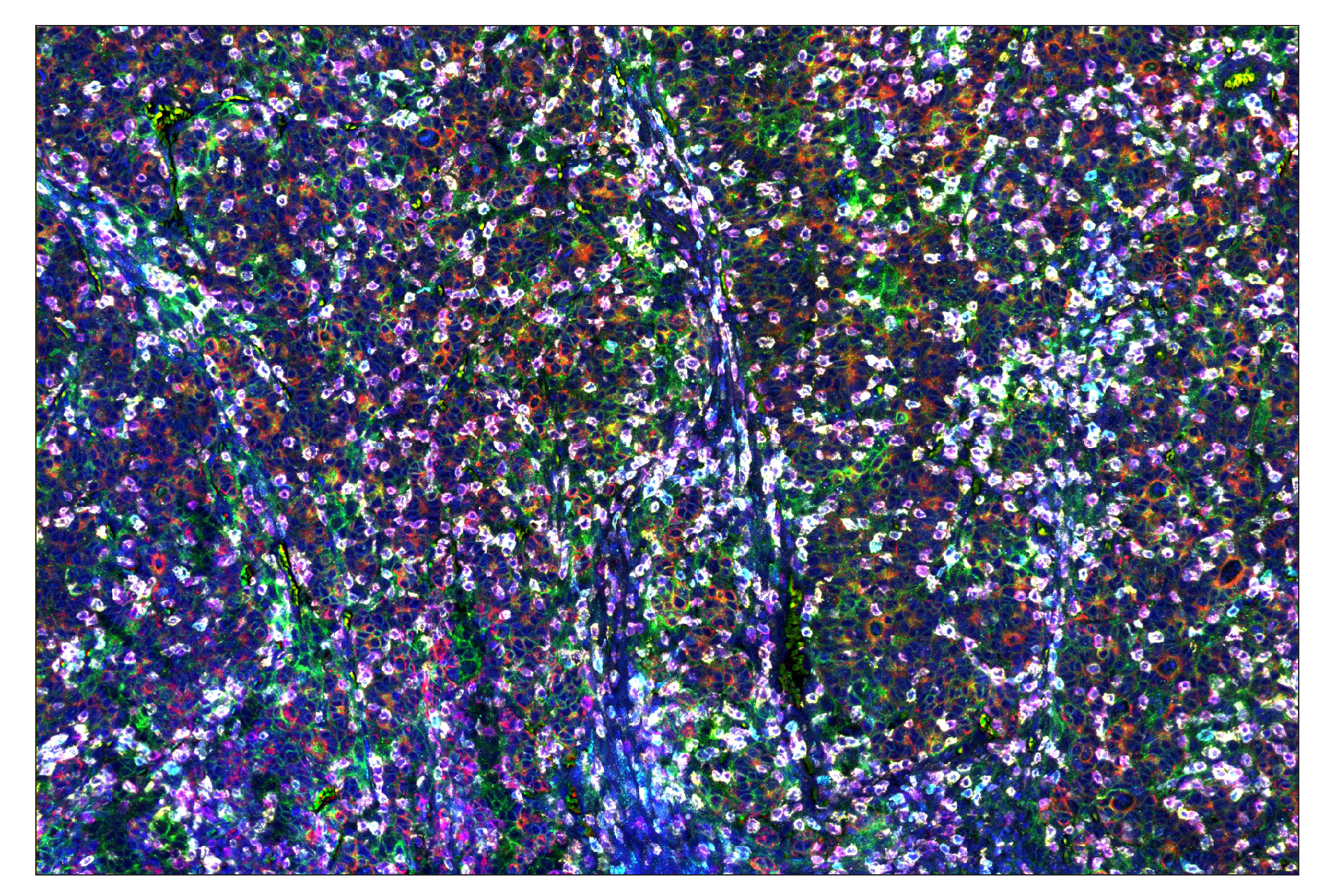 Immunohistochemistry Image 1: CD8α (D8A8Y) & CO-0004-647 SignalStar™ Oligo-Antibody Pair