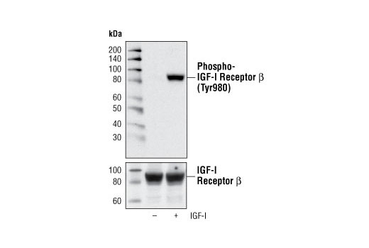  Image 6: Phospho-Insulin/IGF Receptor Antibody Sampler Kit