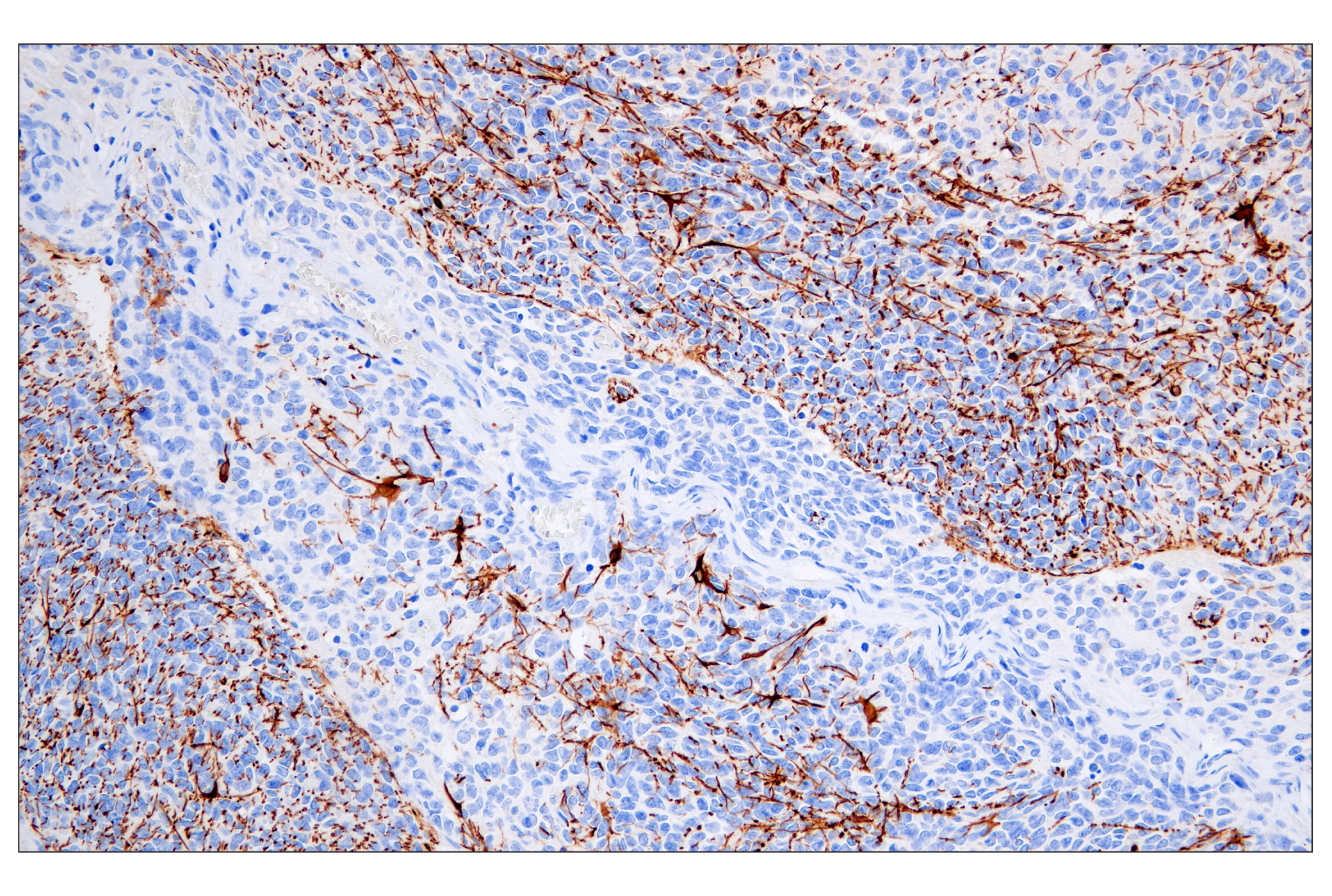 Immunohistochemistry Image 6: GFAP (E4L7M) XP® Rabbit mAb (BSA and Azide Free)