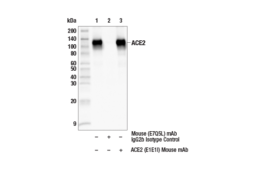 Immunoprecipitation Image 1: ACE2 (E1E1I) Mouse mAb