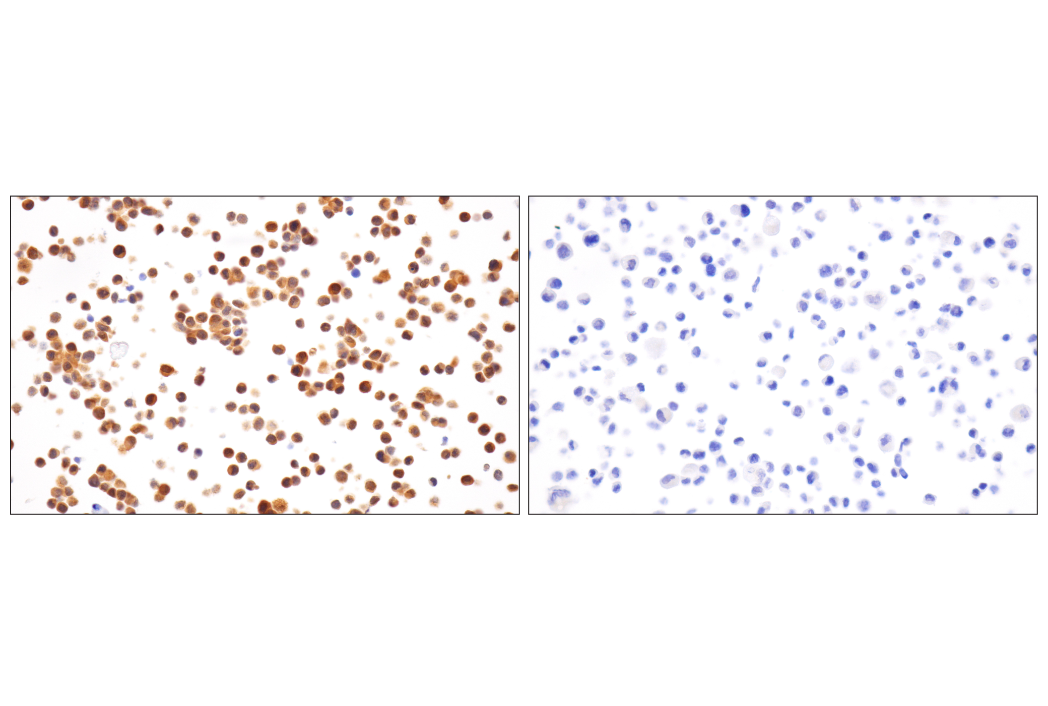 Immunohistochemistry Image 11: Caspase-8 (F5K9P) Rabbit mAb (BSA and Azide Free)