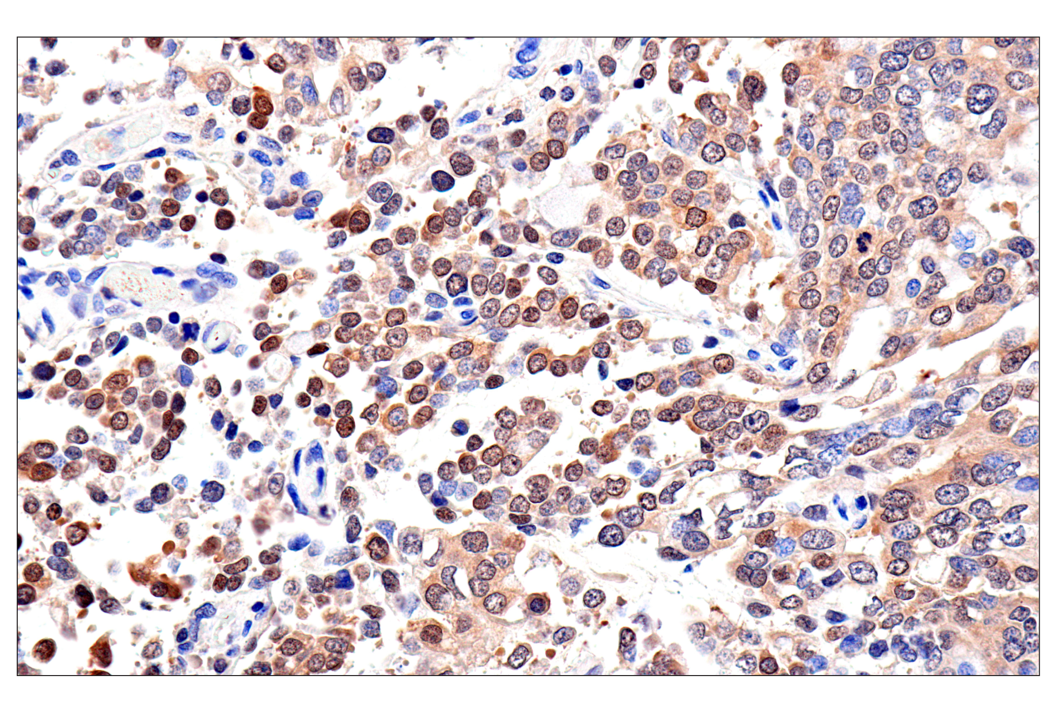 Immunohistochemistry Image 1: Caspase-8 (F5K9P) Rabbit mAb (BSA and Azide Free)