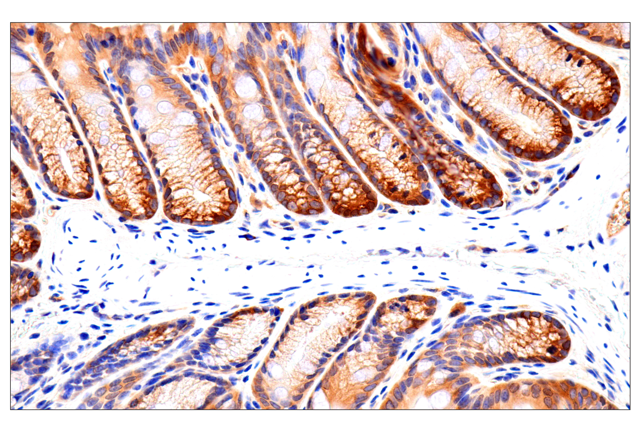 Immunohistochemistry Image 5: Caspase-8 (F5K9P) Rabbit mAb (BSA and Azide Free)