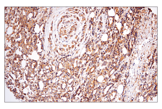Immunohistochemistry Image 1: Rab5A (E6N8S) Mouse mAb