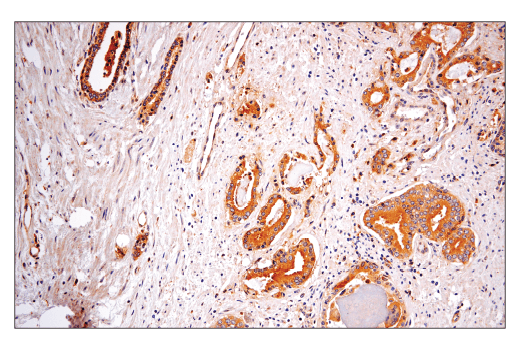 Immunohistochemistry Image 4: Rab5A (E6N8S) Mouse mAb