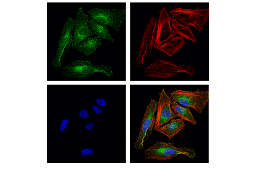Immunofluorescence Image 1: Rab5A (E6N8S) Mouse mAb