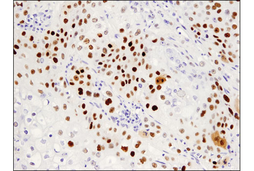Immunohistochemistry Image 3: p53 (DO-7) Mouse mAb (BSA and Azide Free)