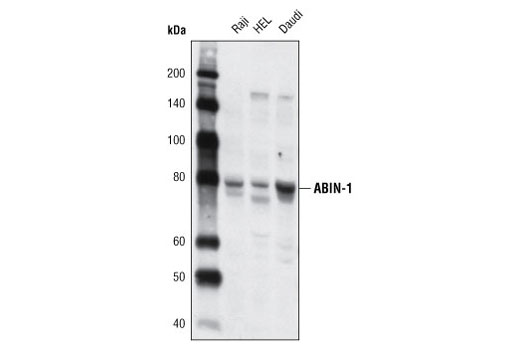 Western Blotting Image 1: ABIN-1 Antibody
