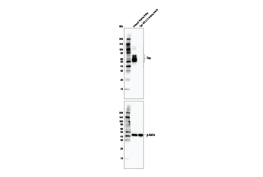  Image 11: LRP1-mediated Endocytosis and Transmission of Tau Antibody Sampler Kit