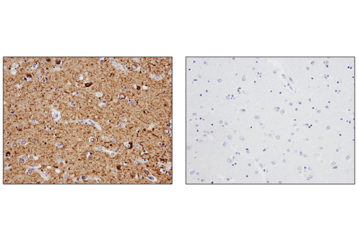  Image 28: LRP1-mediated Endocytosis and Transmission of Tau Antibody Sampler Kit