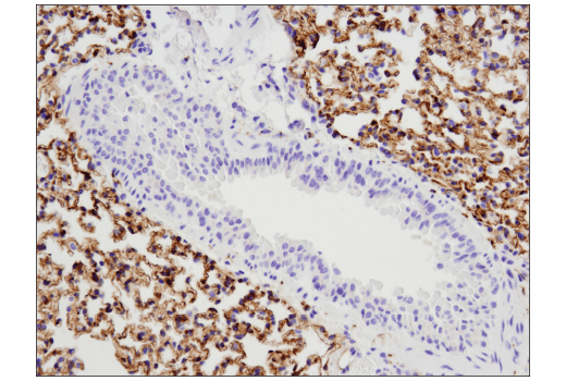  Image 39: LRP1-mediated Endocytosis and Transmission of Tau Antibody Sampler Kit