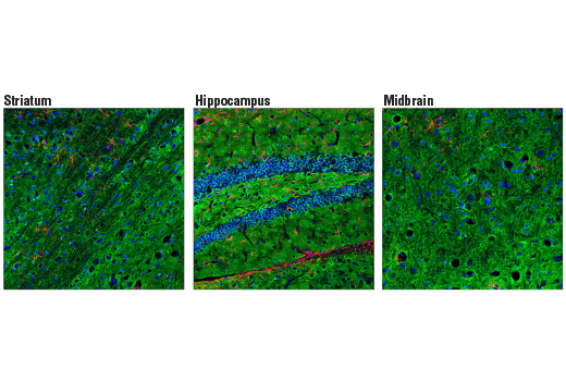  Image 39: LRP1-mediated Endocytosis and Transmission of Tau Antibody Sampler Kit