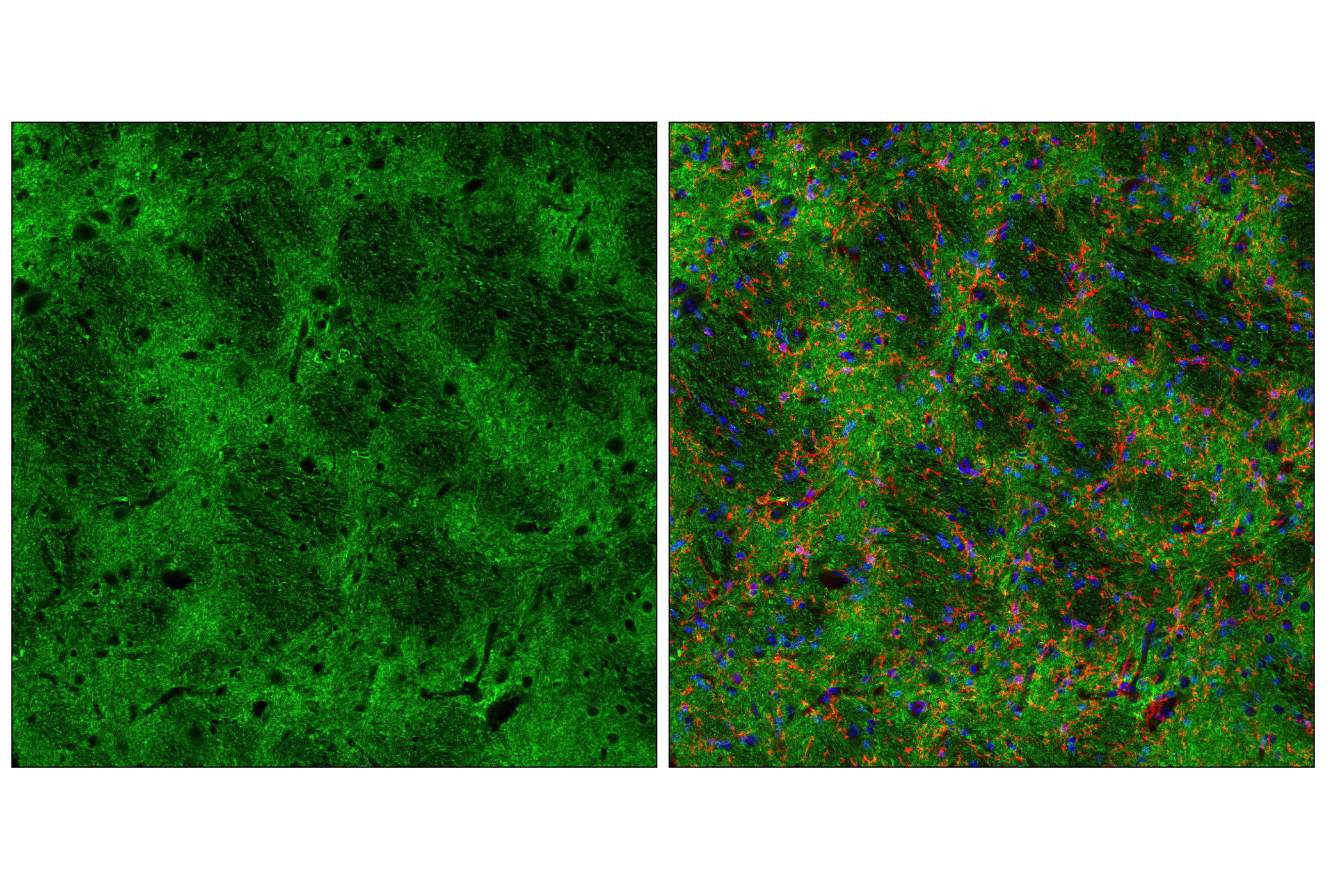  Image 42: LRP1-mediated Endocytosis and Transmission of Tau Antibody Sampler Kit
