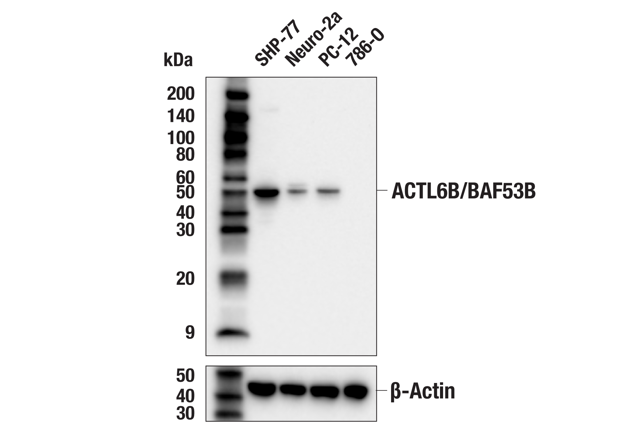 Western Blotting Image 1: ACTL6B/BAF53B (E5X8C) Rabbit mAb
