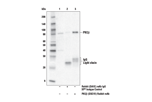 Immunoprecipitation Image 1: PKCβ (D3E7O) Rabbit mAb