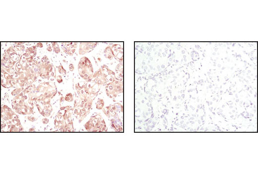 Immunohistochemistry Image 1: Akt (pan) (11E7) Rabbit mAb