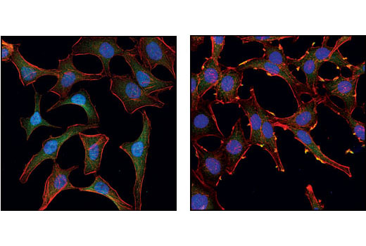 Immunofluorescence Image 1: Akt (pan) (11E7) Rabbit mAb