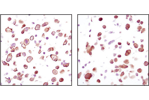 Image 17: AS160 Signaling Antibody Sampler Kit