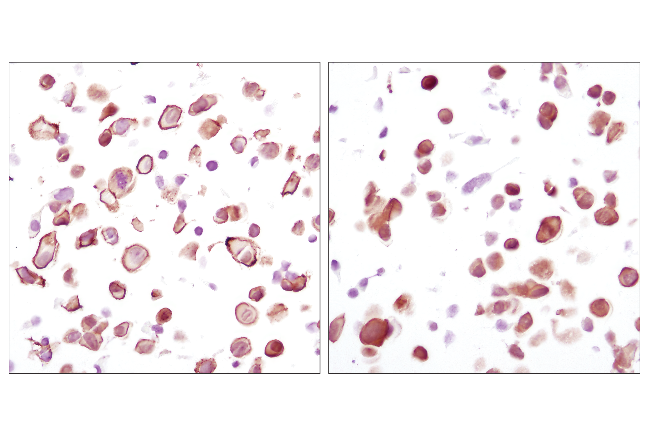  Image 20: AS160 Signaling Antibody Sampler Kit
