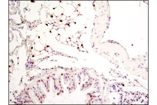 Immunohistochemistry Image 1: C/EBPα (D56F10) XP® Rabbit mAb (BSA and Azide Free)