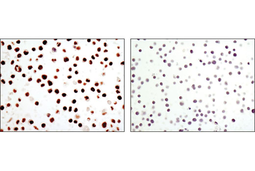 Immunohistochemistry Image 2: C/EBPα (D56F10) XP® Rabbit mAb (BSA and Azide Free)
