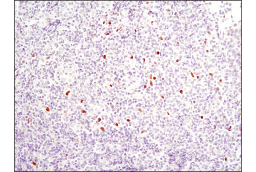 Immunohistochemistry Image 4: C/EBPα (D56F10) XP® Rabbit mAb (BSA and Azide Free)