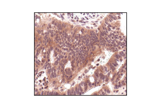 Immunohistochemistry Image 2: MEK1/2 (L38C12) Mouse mAb