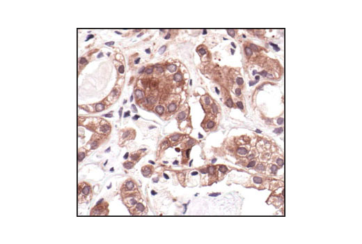 Immunohistochemistry Image 3: MEK1/2 (L38C12) Mouse mAb