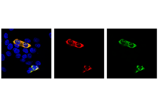 Immunofluorescence Image 1: Cas9 (S. aureus) (6H4) Mouse mAb (Alexa Fluor® 555 Conjugate)