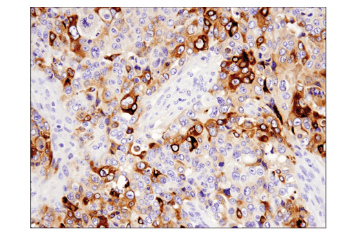  Image 27: TGF-β Fibrosis Pathway Antibody Sampler Kit