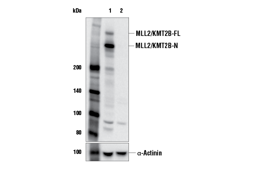 Western Blotting Image 1: MLL2/KMT2B (E3M1V) Rabbit mAb (Amino-terminal Antigen)