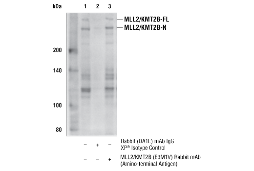 Immunoprecipitation Image 1: MLL2/KMT2B (E3M1V) Rabbit mAb (Amino-terminal Antigen)