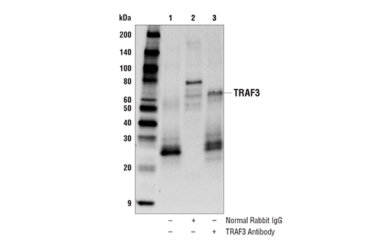  Image 19: NF-κB Non-Canonical Pathway Antibody Sampler Kit