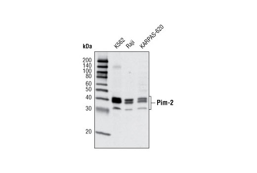  Image 5: Pim Kinase Antibody Sampler Kit