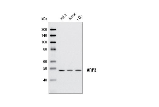 Western Blotting Image 1: ARP3 Antibody