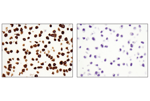 Immunohistochemistry Image 7: TNFRSF8/CD30 (E4L4I) XP® Rabbit mAb (BSA and Azide Free)