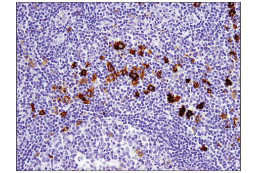 Immunohistochemistry Image 5: TNFRSF8/CD30 (E4L4I) XP® Rabbit mAb (BSA and Azide Free)