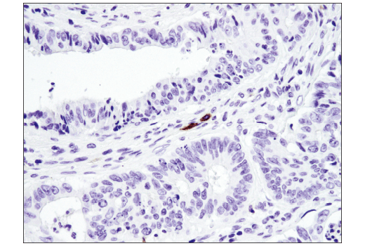 Immunohistochemistry Image 4: TNFRSF8/CD30 (E4L4I) XP® Rabbit mAb (BSA and Azide Free)