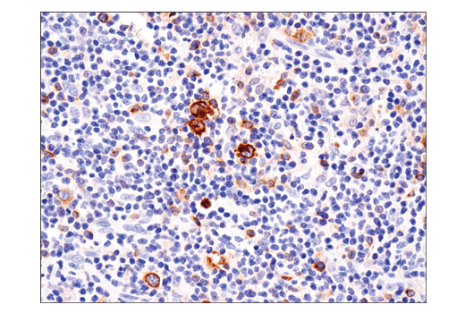 Immunohistochemistry Image 2: TNFRSF8/CD30 (E4L4I) XP® Rabbit mAb (BSA and Azide Free)
