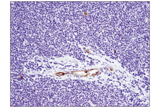 Immunohistochemistry Image 3: TNFRSF8/CD30 (E4L4I) XP® Rabbit mAb (BSA and Azide Free)
